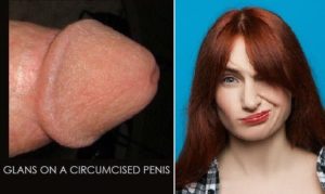 Read more about the article Circumcision Adversely Affects Female Pleasure